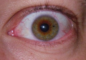 From the Archive: Deus Ex Human Revolution - Oh The Humanity 1 Temporary vision enhancement implants. Also known as a contact lens